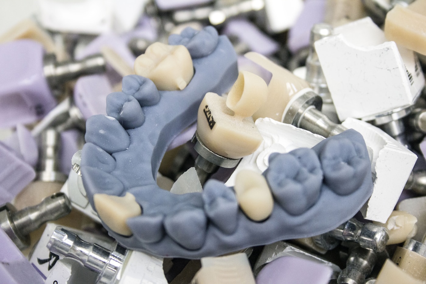Dental crown models on a work surface